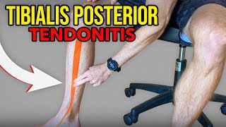 3 Exercises for Tibialis Posterior Tendonitis [upl. by Jeffery809]