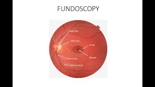 HOW TO DO FUNDOSCOPY OR OPHTHALMOSCOPY [upl. by Efar]