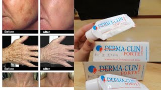 Derma Clin Forte Medicated Cream 100 Working Results  Honest Review Uses amp Benafits Price [upl. by Scibert]