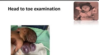 Head to Toe Examination in Newborn I Newborn Examination Part3  Paediatrics [upl. by Mccowyn]