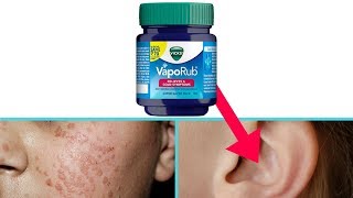 7 Surprising Uses amp Benefits of Vicks Vaporub You Must Know [upl. by Navac321]