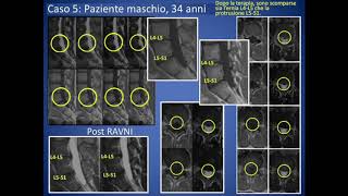 Risonanze Magnetiche Prima  Dopo Trattamenti del DottSaidbegov [upl. by Woodring]