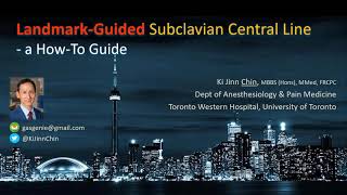 LANDMARKguided Subclavian Central Line Insertion  a HowTo Guide [upl. by Salem]