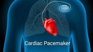 Cardiac Pacemaker [upl. by Amalberga197]