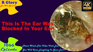 This Is The Ear Wax Blocked In Your Ear New Video Ear Wax Removal 1066 earwax earwaxremoval [upl. by Ecirad]