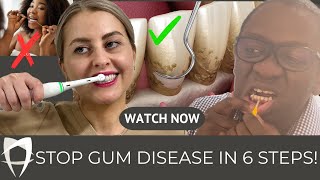 Gum Disease Treatment 2024  Periodontists Comprehensive Guide Including Causes and Treatment [upl. by Nitaf]