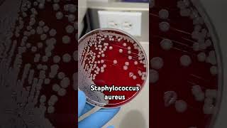 Staphylococcus aureus ❤️🧫 CocosPositivos bacteriologia microbiología [upl. by Sosna]