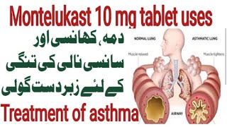 montelukast 10 mg tablet  montiget tablet 10mg  asthma treatment  dry cough treatment  dama ka [upl. by Avirt]