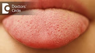 What causes small red patches on tongue  Dr Sana Taher [upl. by Ennayoj]