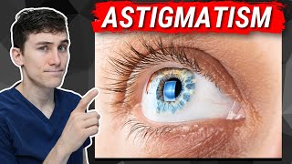 Astigmatism Explained  What You Need to Know [upl. by Lamahj98]