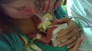 Premature Babies  One Born Every Minute [upl. by Levan]