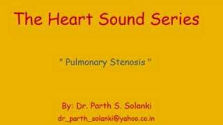 Pulmonary Stenosis [upl. by Nylikcaj]