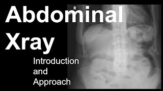 Abdominal Xray Introduction and Approach [upl. by Teufert512]