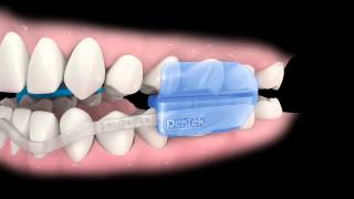 ComfortFit Dental Guard Instructions [upl. by Ahsirtap]