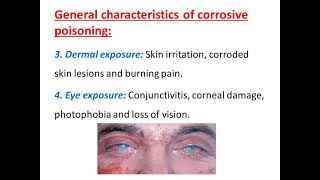 Corrosives 1 [upl. by Leavelle]