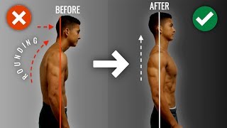 How To Fix Rounded Shoulders FAST 10 Minute ScienceBased Corrective Routine [upl. by Aerdnad]