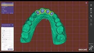 exocad making a collapsible model [upl. by Luckin]