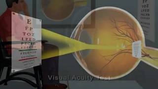 Visual acuity test  Animated Concise Dictionary of Ophthalmology [upl. by Lewin]