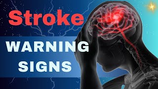 Stroke Warning Signs and 10 Tips for Prevention [upl. by Arayc]