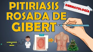 PITIRIASIS ROSADA DE GIBERT  GILBERT   ¿cuánto dura clínica tratamiento📝👨🏻‍⚕️EXPLICACIÓN FÁCIL [upl. by Raquela]