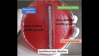 Satellitism Test Positive of Haemophilus influenzae [upl. by Yatnahs]