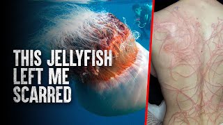 How To Survive The 10 Most Dangerous Jellyfish in the World [upl. by Alia]