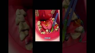 Part1Remove giant tartar stuck between teeth 🦷 🤮  Dental care animation 😱 so satisfying ASMR [upl. by Aubigny]