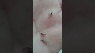 fumigacion dengue culex aedes anopheles [upl. by Nifled909]