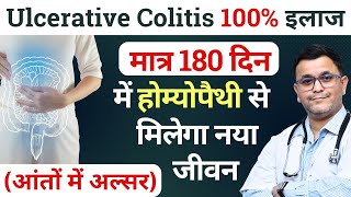 2 BEST Homeopathic medicine for Ulcerative Colitis you MUST take [upl. by Aninat]