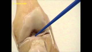 Anatomy of the knee joint [upl. by Truc]