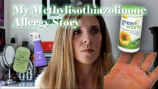 My Methylisothiazolinone allergy and dyshidrotic hand eczema story [upl. by Katheryn]