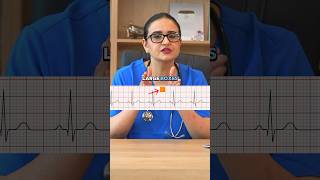 How To Read A ECG Rhythm shorts ecg ecginterpretation nclex [upl. by Rodoeht717]