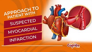 Approach to Patient with Suspected Myocardial Infarction  MCCQE1 Objective [upl. by Alyahsat]