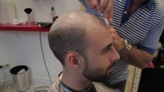 Hair Replacement for Men at The Hair Clinic Montreal featuring The Non Surgical Hair Transplant [upl. by Darrel]