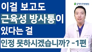 근육성 방사통 좌골신경통 근육치료후기 무려 7년간의 방사통이 하루만에 좋아지다니 [upl. by Yanaton830]