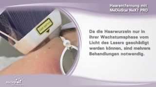 Haarentfernung mit dem Diodenlaser MeDioStar NeXT PRO von Asclepion [upl. by Carvey573]