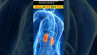 trans kidney transplant ke bad kidney ko sakte hain ki rakh dete Hain factsinhindi amazingfacts [upl. by Hayila]