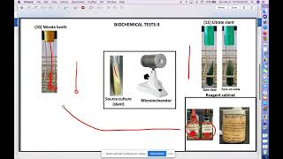 Biochemical Test Nitrate and Citrate Test Part 1 [upl. by Karil2]