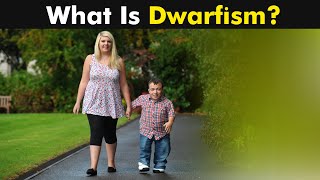 What is Dwarfism  Types Causes and Symptoms UrduHindi [upl. by Chyou854]