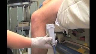 How To Deep Vein Thrombosis Detection with Ultrasound Part 1 Case Study Video [upl. by Nadeen400]