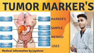 Tumor Markers  Cancer Markers  Cancer Diagnosis amp monitoring  Medical Information  byjayshree [upl. by Neom]