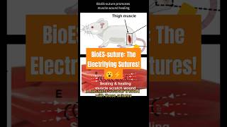 BioESsuture The Electrifying Sutures 😮⚡shorts technology science [upl. by Eihtur]