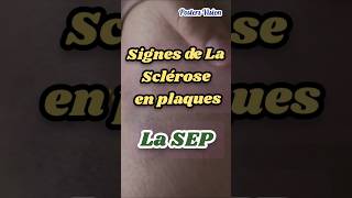 Signes Symptômes Sclérose en plaques SEP scleroseenplaques TroublesDuSommeil neurodegenerative [upl. by Akiraa]