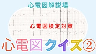 心電図解説場（心電図クイズ②） [upl. by Survance319]