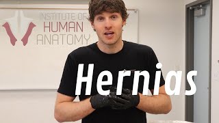 What Are Hernias [upl. by Peregrine]