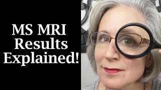 MS MRI Results Lesions and Atrophy Explained [upl. by Leupold]