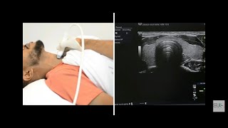 Thyroid Ultrasound Protocol [upl. by Ycniuqal636]