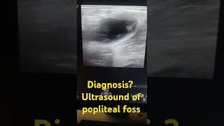 diagnosticradiology ultrasonography radiology msk interesting facts life song [upl. by Ashford]