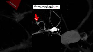 Brain cell restructures itself after forming a new connection neuroplasticity neuroscience brain [upl. by Salamone185]