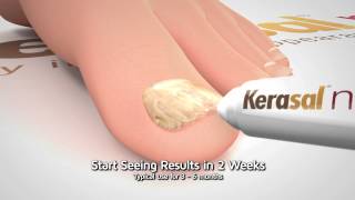 Kerasal Nail Restore Healthy Nail Appearance 10 Sec [upl. by Errot]